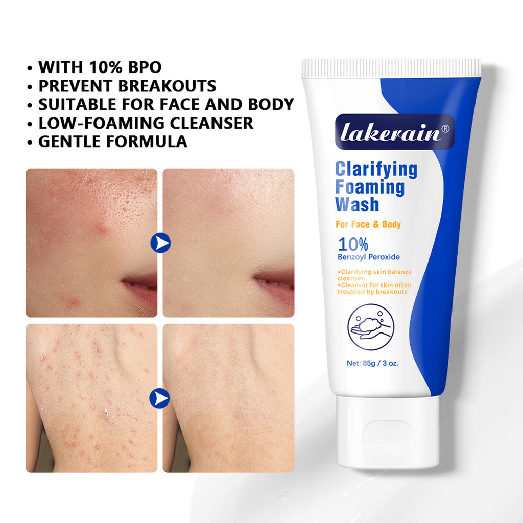 Acne Foam Facial Cleanser Skin Type Universal